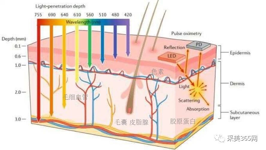 油皮痘肌的福音科医人aopt超光子up雷射有效治疗痤疮瘢痕