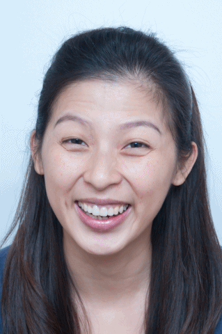 如何祛除抬头纹?别再让抬头纹显得老气横秋