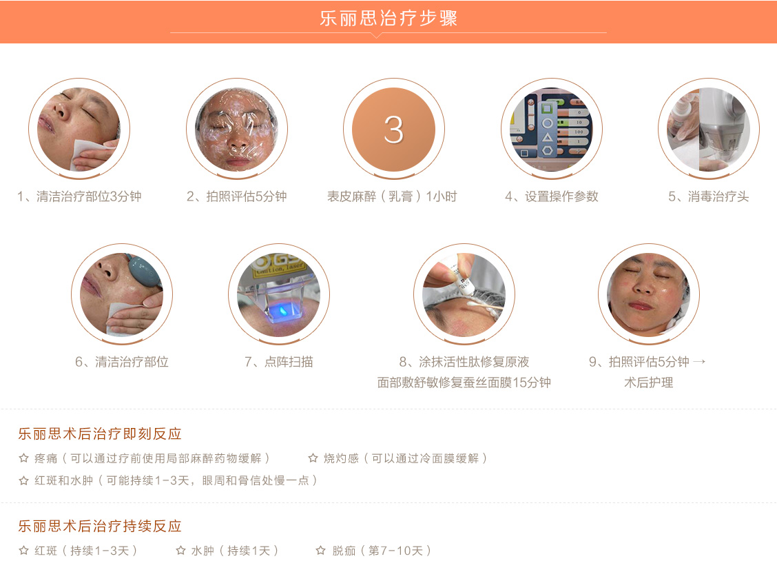 采美GSD乐丽思1550nm点阵激光，嫩肤祛皱修复疤痕修复妊娠纹，治疗黄褐斑脱发