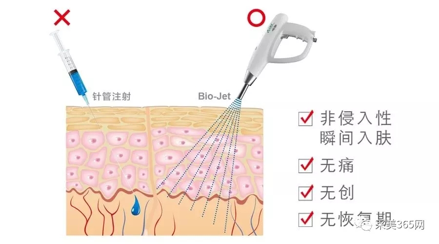 2018热门中胚层疗法导入仪有针水光美塑枪无针水光雾化导入多功能导入