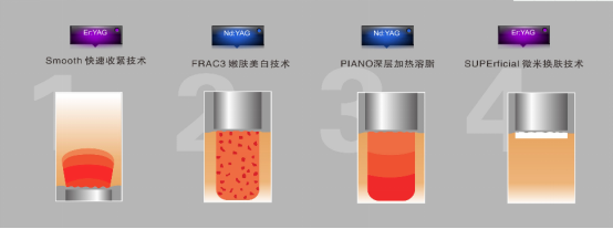 https://img.caimei365.com/group1/M00/00/DF/Cmis21qc2xOAWi4zAAC1pYchAOQ411.png