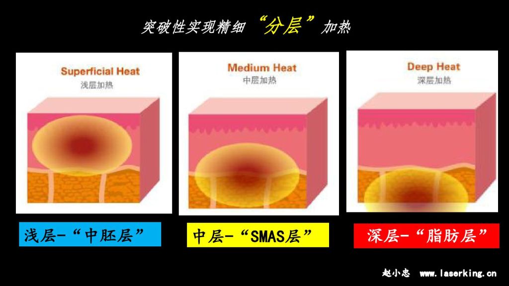 热拉提,突破性实现精细分层加热