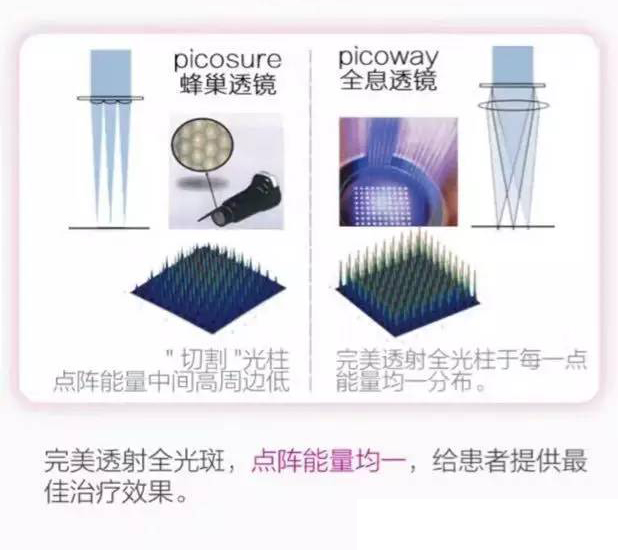 皮秒激光:PicoWay全息透镜与PicoSure蜂巢透镜