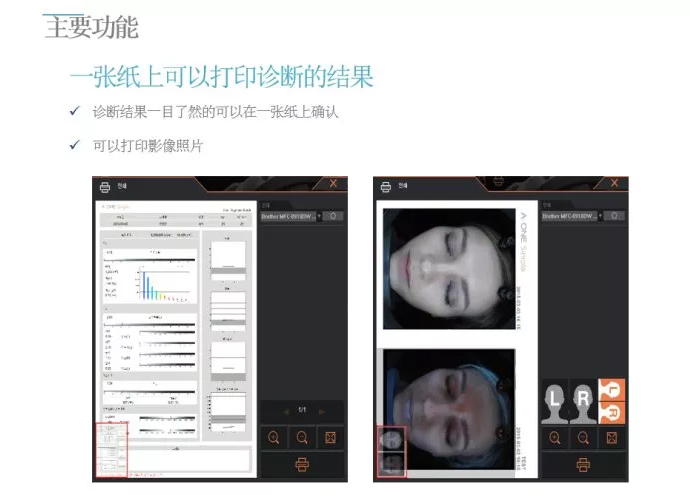 A-one Smart 面部诊断系统