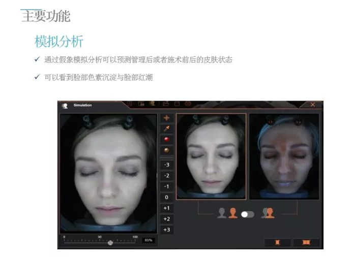 A-one Smart 面部诊断系统