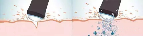 焕氧泡泡,动能洁肤,焕氧泡泡,科医人