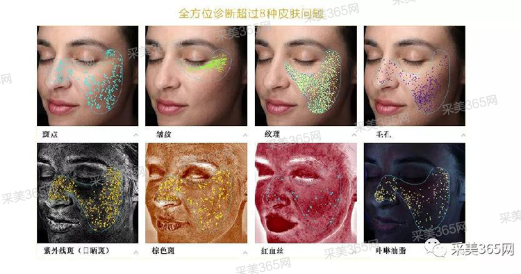 2018热门皮肤检测仪,光电微整好助手