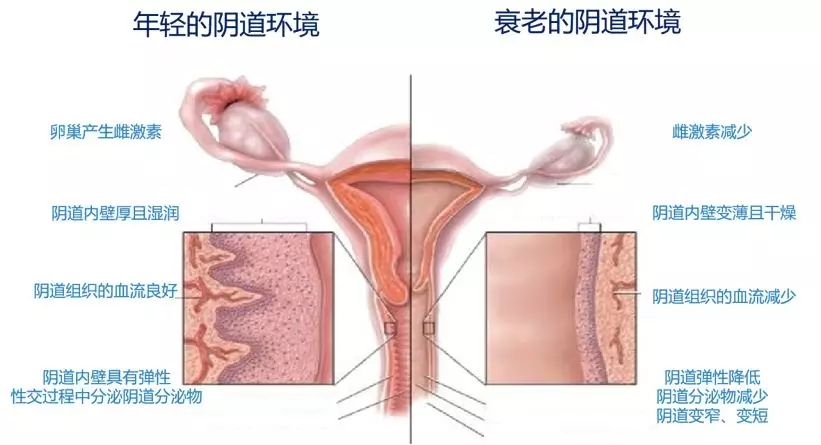 采美新品科医人femtouch维密专注女性私密美学和健康